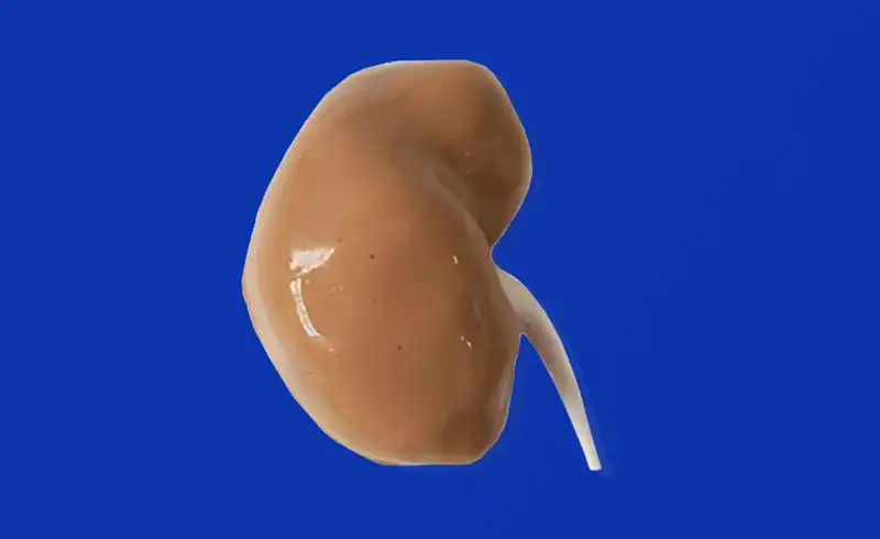 3D Kidney Model(HSX005)